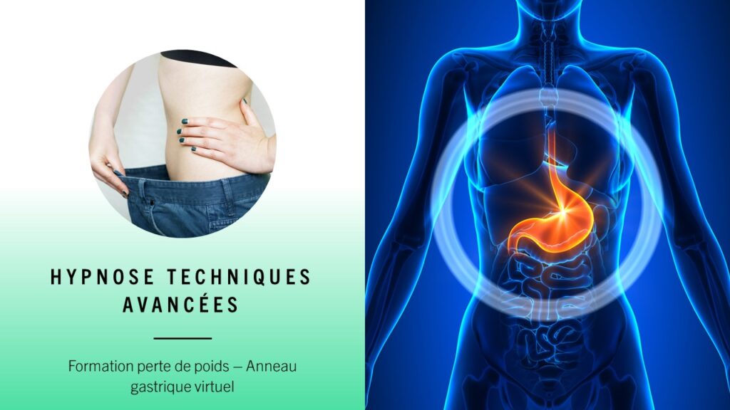 Hypnose techniques avancées formation perte de poids - anneau gastrique virtuel